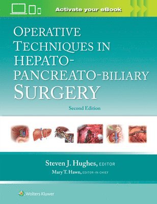 Operative Techniques in Hepato-Pancreato-Biliary Surgery: Print + eBook with Multimedia 1