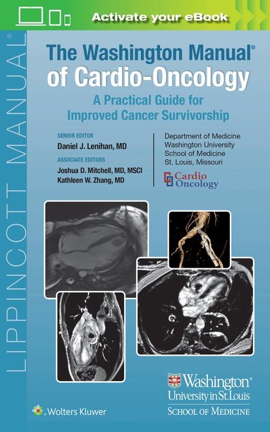 Daniel J. Lenihan, Kathleen W. Zhang, Joshua Mitchell, - Washington Manual of Cardio-Oncology, Häftad