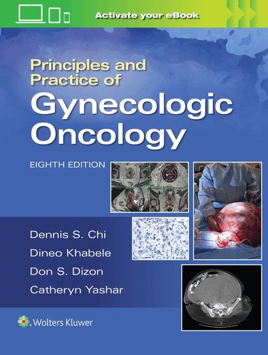 DENNIS CHI, Andrew Berchuck, Don S. Dizon, Catheryn M. Yashar - Principles and Practice of Gynecologic Oncology, Inbunden