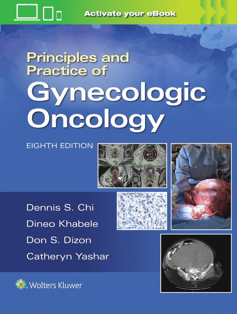 DENNIS CHI, Andrew Berchuck, Don S. Dizon, Catheryn M. Yashar, Dennis Chi - Principles and Practice of Gynecologic Oncology, Inbunden