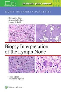 bokomslag Biopsy Interpretation of the Lymph Node: Print + eBook with Multimedia