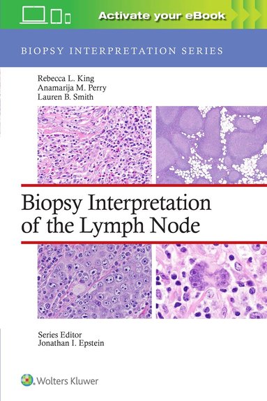 Rebecca Leigh King, Anamarija M. Perry, Lauren B. Smith - Biopsy Interpretation of the Lymph Node: Print + eBook with Multimedia, Inbunden