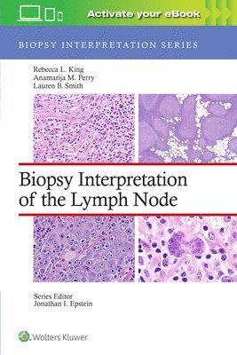bokomslag Biopsy Interpretation of the Lymph Node