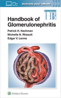 bokomslag Handbook of Glomerulonephritis