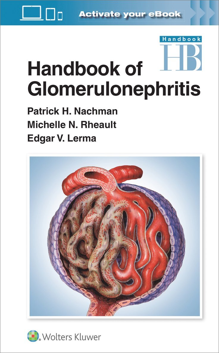 Patrick Henry Nachman, Edgar Lerma, Michelle Rheault - Handbook of Glomerulonephritis, Häftad