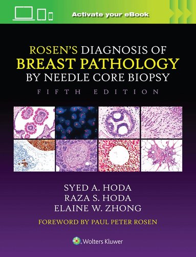Syed A. Hoda, Raza S. Hoda, Elaine Zhong - Rosen's Diagnosis of Breast Pathology by Needle Core Biopsy, Inbunden