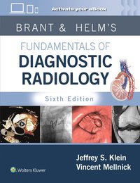 bokomslag Brant & Helms' Fundamentals of Diagnostic Radiology: Print + eBook with Multimedia