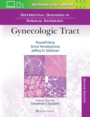 bokomslag Differential Diagnoses in Surgical Pathology: Gynecologic Tract