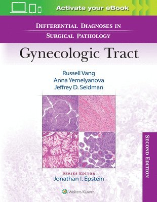 Russell Vang, Anna Yemelyanova, Jeffrey D. Seidman, MD Yemelyanova, Anna, MD Seidman, Jeffrey D. - Differential Diagnoses in Surgical Pathology: Gynecologic Tract, Inbunden