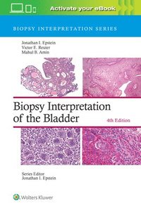bokomslag Biopsy Interpretation of the Bladder: Print + eBook with Multimedia