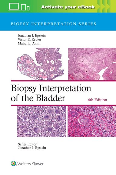 Jonathan I. Epstein, Victor E. Reuter, Mahul B. Amin - Biopsy Interpretation of the Bladder: Print + eBook with Multimedia, Inbunden