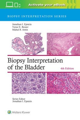 Biopsy Interpretation of the Bladder: Print + eBook with Multimedia 1