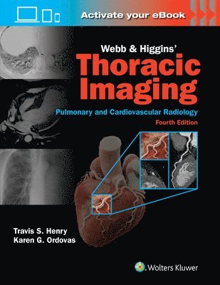 bokomslag Webb & Higgins Thoracic Imaging: Print + eBook with Multimedia