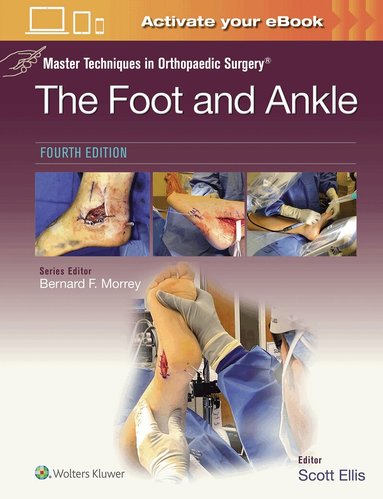 Scott Ellis - Master Techniques in Orthopaedic Surgery: The Foot and Ankle: Print + eBook with Multimedia, Inbunden