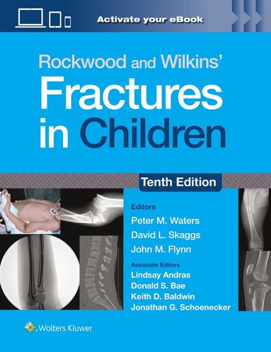 bokomslag Rockwood and Wilkins' Fractures in Children: Print + eBook with Multimedia