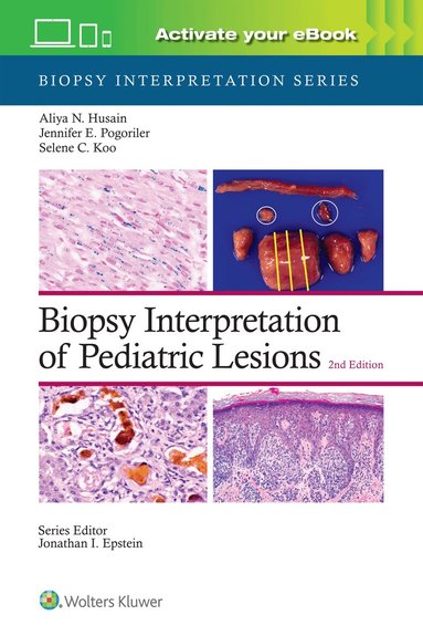 ALIYA NOOR HUSAIN - Biopsy Interpretation of Pediatric Lesions: Print + eBook with Multimedia, Inbunden