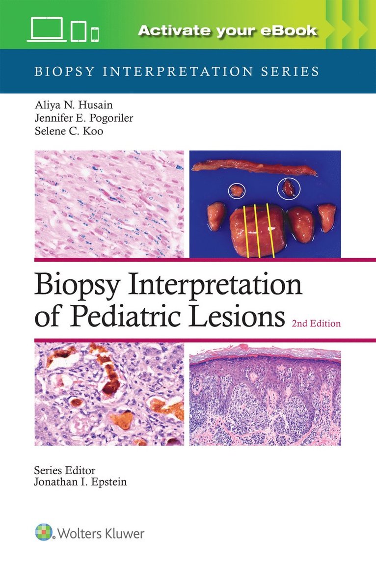 Biopsy Interpretation of Pediatric Lesions: Print + eBook with Multimedia 1