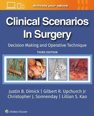 JUSTIN B DIMICK, GILBERT R. UPCHURCH JR, CHRISTOPHER J. SONNENDAY, LILLIAN S. KAO, JR UPCHURCH, GILBERT R., Justin B. Dimick, Gilbert R. Upchurch, GILBERT R. UPCHURCH, Justin B Dimick, Christopher J. Sonnenday, Lillian S. Kao - Clinical Scenarios in Surgery, Inbunden
