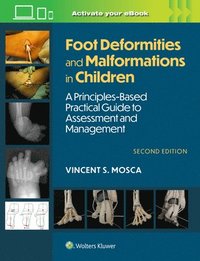 bokomslag Foot Deformities and Malformations in Children: A Principles-Based, Practical Guide to Assessment and Management: Print + eBook with Multimedia