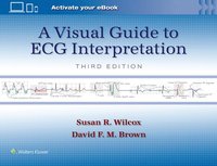 bokomslag A Visual Guide to ECG Interpretation: Print + eBook with Multimedia