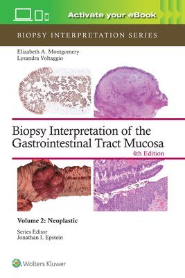 bokomslag Biopsy Interpretation of the Gastrointestinal Tract Mucosa Volume 2