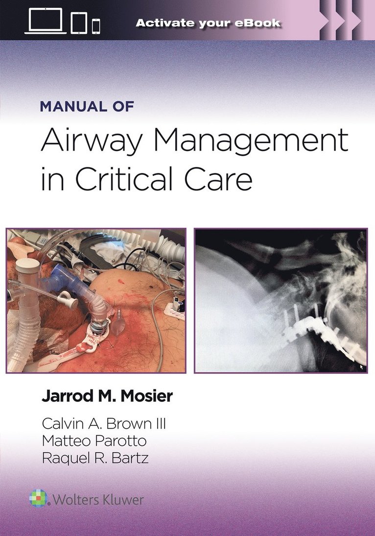 Manual of Airway Management in Critical Care: Print + eBook with Multimedia 1