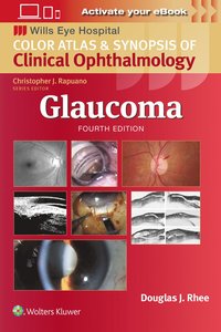 bokomslag Glaucoma