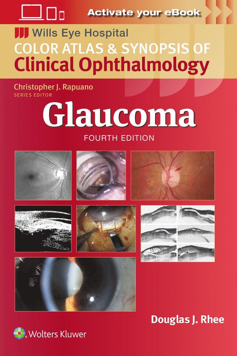 Douglas J. Rhee, Douglas J Rhee - Glaucoma, Häftad