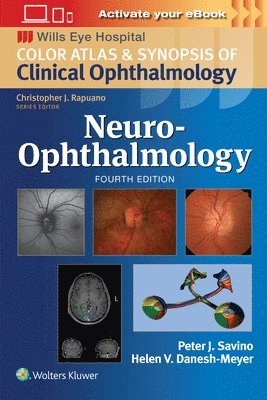 Neuro-Ophthalmology: Print + eBook with Multimedia 1