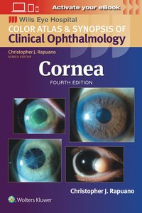 bokomslag Cornea: Print + Ebook With Multimedia