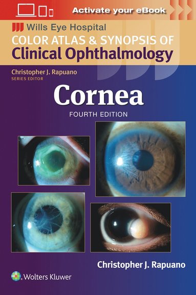 bokomslag Cornea: Print + eBook with Multimedia