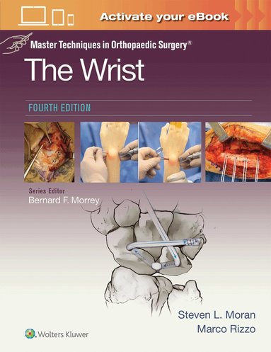 STEVEN L MORAN, Marco Rizzo - Master Techniques in Orthopaedic Surgery: The Wrist: Print + eBook with Multimedia, Inbunden