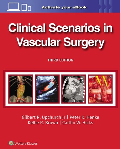 GILBERT R. UPCHURCH JR, PETER HENKE, Kellie R. Brown, Caitlin Whitney Hicks - Clinical Scenarios in Vascular Surgery, Inbunden