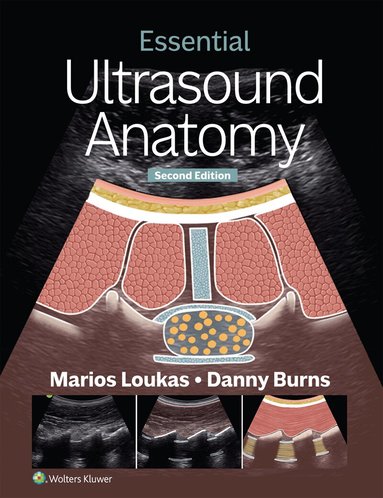 Marios Loukas, Danny Burns - Essential Ultrasound Anatomy, Häftad