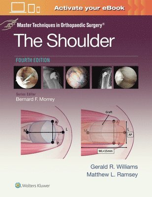 GERALD R. WILLIAMS JR., MATTHEW L. RAMSEY, MD WILLIAMS, GERALD R., JR., MD RAMSEY, MATTHEW L., Gerald R. Williams, Matthew L. Ramsey, GERALD R. WILLIAMS - Master Techniques in Orthopaedic Surgery: The Shoulder: Print + eBook with Multimedia, Inbunden