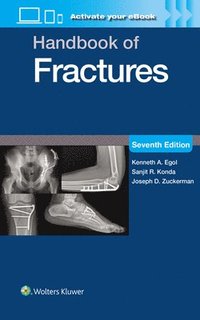 bokomslag Handbook of Fractures: Print + eBook with Multimedia