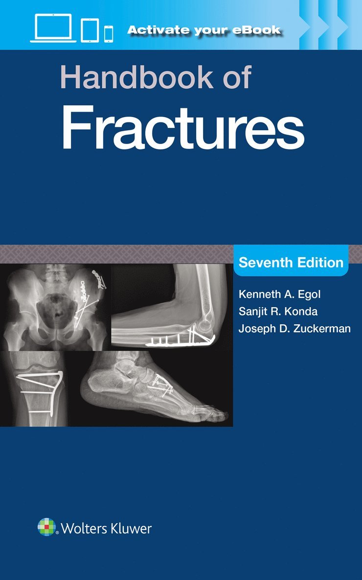 Handbook of Fractures: Print + eBook with Multimedia