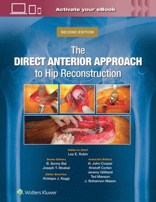 The Direct Anterior Approach to Hip Reconstruction 1