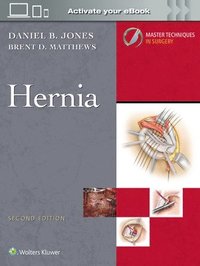 bokomslag Master Techniques in Surgery: Hernia: Print + eBook with Multimedia