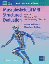 bokomslag Musculoskeletal MRI Structured Evaluation: How to Efficiently Fill in the Reporting Checklist
