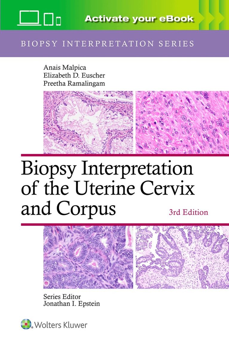 Biopsy Interpretation of the Uterine Cervix and Corpus: Print + eBook with Multimedia