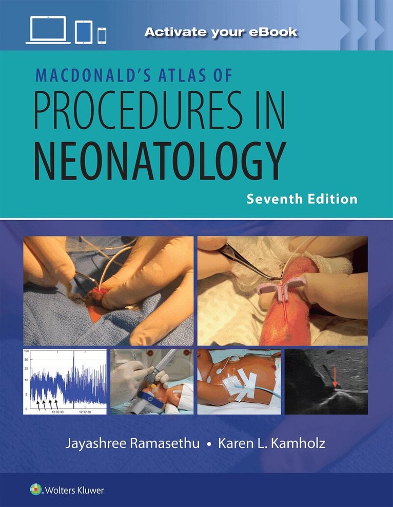 JAYASHREE RAMASETHU, SUNA SEO, Karen L. Kamholz - MacDonald’s Atlas of Procedures in Neonatology Print + eBook with Multimedia, Inbunden. Tillgänglighet: Lägg i varukorg