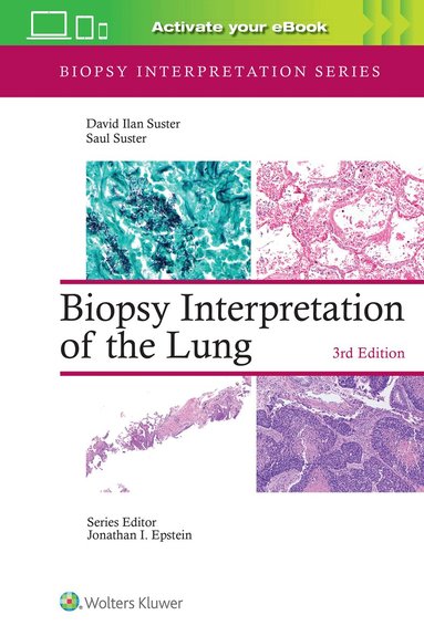 DAVID ILAN SUSTER, SAUL SUSTER - Biopsy Interpretation of the Lung, Inbunden
