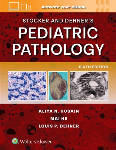 ALIYA NOOR HUSAIN, Mai He, LOUIS P. DEHNER - Stocker and Dehner's Pediatric Pathology, Inbunden
