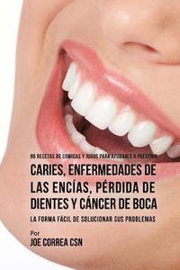 bokomslag 86 Recetas de Comidas y Jugos Para Ayudarle A Prevenir Caries, Enfermedades de Las Encías, Pérdida de Dientes y Cáncer de Boca: La Forma Fácil de Solu