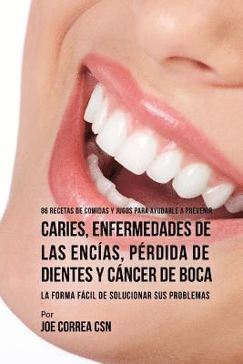 bokomslag 86 Recetas de Comidas y Jugos Para Ayudarle A Prevenir Caries, Enfermedades de Las Encías, Pérdida de Dientes y Cáncer de Boca: La Forma Fácil de Solu