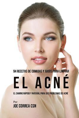 94 Recetas De Comidas Y Jugos Para Limpiar El Acné: El Camino Rápido Y Natural Para Sus Problemas de Acné 1