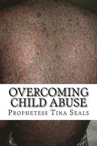 bokomslag Overcoming Child Abuse