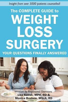 bokomslag The Complete Guide to Weight Loss Surgery: Your questions finally answered