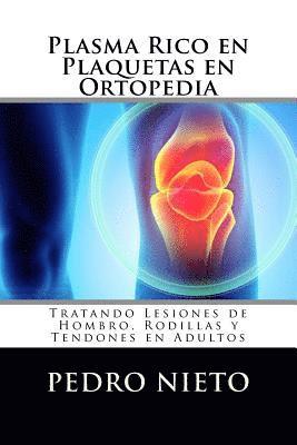 Pedro Nieto - Plasma Rico en Plaquetas en Ortopedia: Tratando Lesiones de Hombro, Rodillas y Tendones en Adultos, Häftad